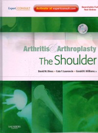 Arthristis & artroplasty the shoulder