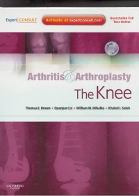 Arthristis & arthroplasty the knee